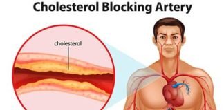 कितना मारक कोलेस्ट्रोल, बहस के बीच धंधा पो बारह