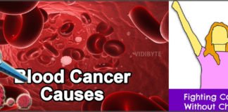 अब कीमोथेरपी नहीं करवा पड़ेगा ब्लड कैंसर के मरीजों को