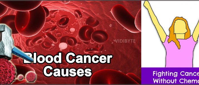 अब कीमोथेरपी नहीं करवा पड़ेगा ब्लड कैंसर के मरीजों को