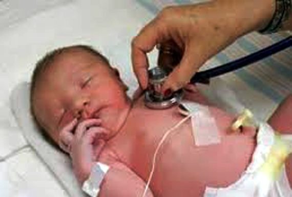 उत्तर प्रदेश: कुपोषण से असमय मर रहे हैं रोजाना 650 बच्चे