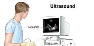 ट्रैकिंग सिस्टम से जुड़ेंगे अल्ट्रासाउंड सेंटर, खर्चा फिफ्टी-फिफ्टी