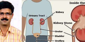 सर्जरी के बाद क्यूं होती है बार-बार पथरी, पता लगा