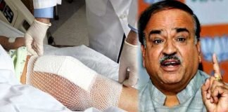 सरकारी ऐलान: स्टंट के बाद ‘घुटना’ सस्ता, दाम पर लगाई लगाम