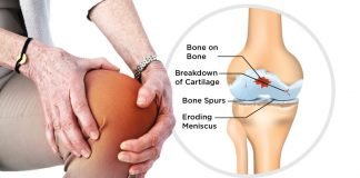 हड्डियों के रोग की दवा में पालक उपयोगी