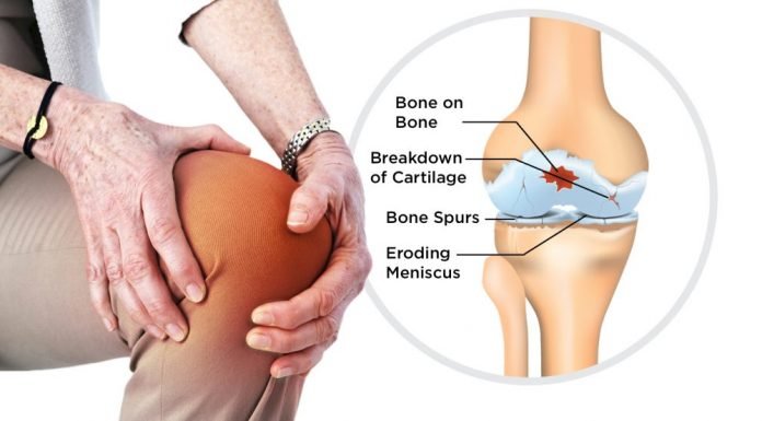 हड्डियों के रोग की दवा में पालक उपयोगी