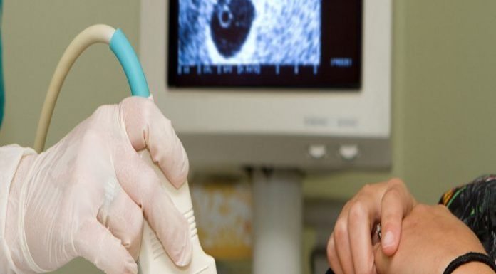 सिविल सर्जन करेंगे भ्रूण लिंग मामले की जांच