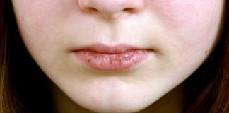 इन निजी अस्पतालों में कटे होंठ का मुफ्त इलाज