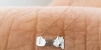 खुद का इलाज करेगी नई लचीली ई-त्वचा