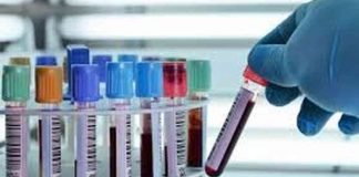 हाईकोर्ट ने अवैध पैथ लैब बंद करने के दिए निर्देश