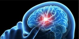 ब्रेन हैम्ब्रेज की दवा ट्रायल के सकारात्मक परिणाम आए सामने