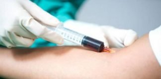 प्रेग्नेंट महिला को चढ़ा दिया एचआईवी संक्रमित खून