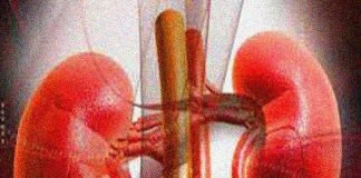 अंतरराष्ट्रीय किडनी रैकेट पकड़ा