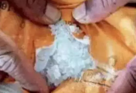 फार्मा कंपनी से 25 करोड़ की ड्रग जब्त, निदेशक गिरफ्तार