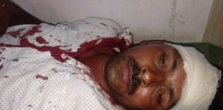 दवा सप्लायर से लूट का प्रयास, मारी गोली