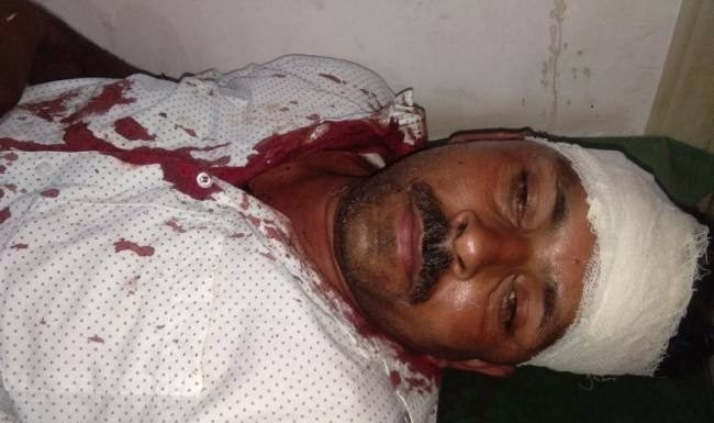 दवा सप्लायर से लूट का प्रयास, मारी गोली