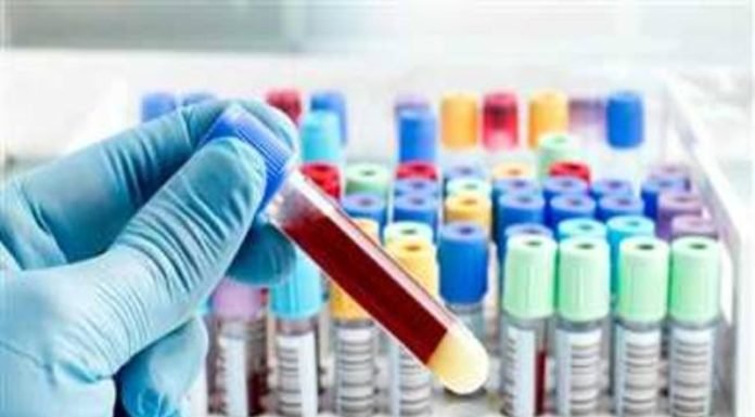 युवक की रिपोर्ट में ‘प्रेग्नेंट’ लिखा, पैथोलॉजी लैब सील