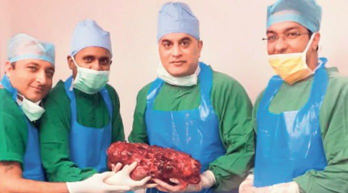 मरीज के शरीर से 7.4 किलो की किडनी निकाली