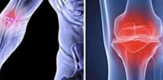 हड्डी के इलाज में नैनोटेक्स बोन ग्राफ्ट चिकित्सा पद्धति को मंजूरी bone