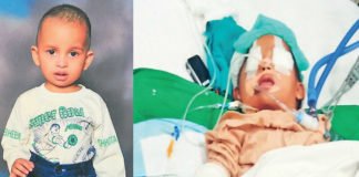 खांसी-जुकाम की दवा पीने से 5 साल का बच्चा कोमा में