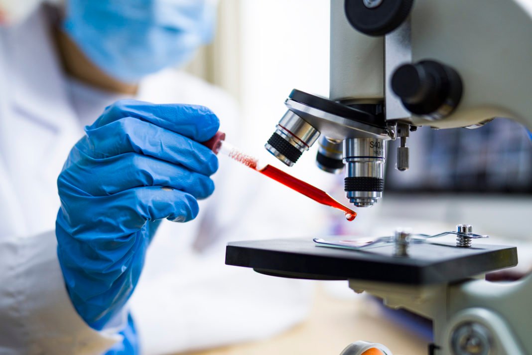 Scientist working with blood sample in