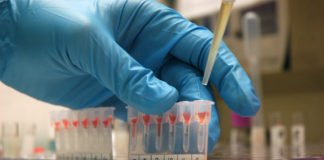 मोबाइल की रोशनी में लिया गया ब्लड सैंपल ब्लड सैंपल