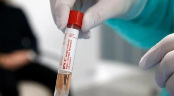 जुएं मारक दवा से मर रहा कोरोना वायरस, अमेरिका में क्लीनिकल ट्रायल शुरू