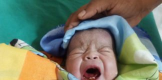 बच्ची ने दो दांत के साथ लिया अस्पताल में जन्म