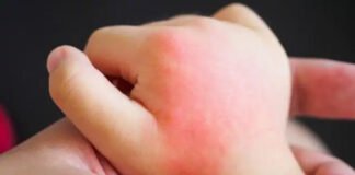 कोरोना संक्रमण के बाद बच्चों पर नए सिन्ड्रोम का हमला