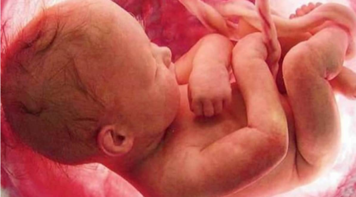 पकडे गए भ्रूण जांच लिंग के दलाल, डॉक्टर चला रहे हैं घिनौना धंधा