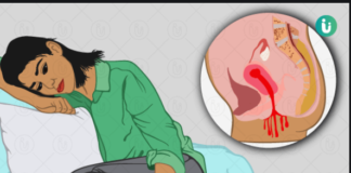 गर्भपात किट के डाटा की होगी फोरेंसिक जांच