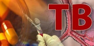 टीबी की दवा रिफैम्पिसिन गुणवत्ता जांच में फेल मिली