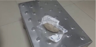 नर्स की लापरवाही, प्रसव के दौरान महिला की बच्चेदानी में छोड़ा पट्टी का रोल