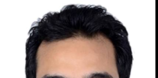 दूषित खानपान के चलते बढ़ रहे हेपेटाइटिस ए और ई के मरीज, दो लोगों की हो चुकी मौत, कई लोग पाए गए पीड़ित