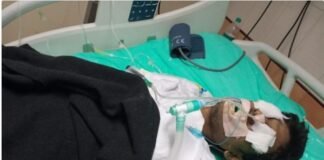 सरकारी हॉस्पिटल की लापरवाही, ICU में एडमिट मरीज की आंख कुतर गया चूहा