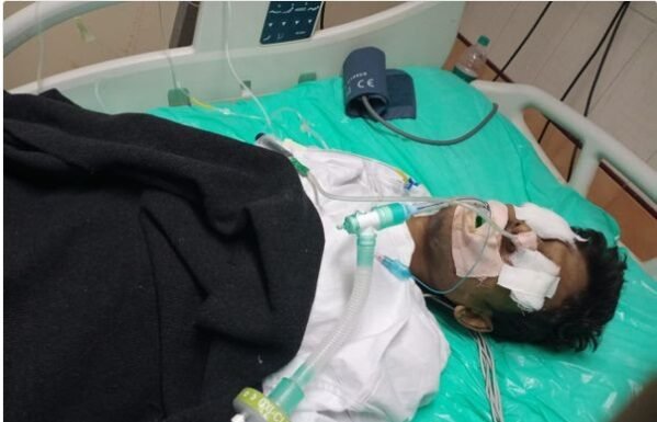 सरकारी हॉस्पिटल की लापरवाही, ICU में एडमिट मरीज की आंख कुतर गया चूहा