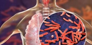 ये मशीन बताएगी टीबी से ग्रसित मरीजों के उपचार में कितनी कारगर है दवा, कुछ मिनट में लगेगा पता