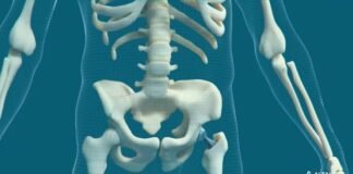 पहली बार भारत में सर्जरी में इस्तेमाल हुआ 3डी प्रिंटेड लैटिस, तंजानिया की थी महिला