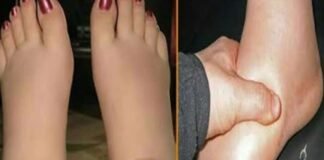 फाइलेरिया की दवा खाने से महिला सहित तीन बच्चे हुए बीमार