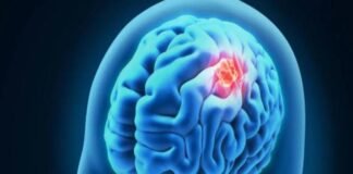 ब्रेन कैंसर के इलाज की जगी उम्मीद, वैज्ञानिकों ने बनाया दवा का नया मिश्रण