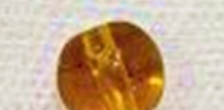 मासूम के फेंफड़े से निकाला गया हार का टुकड़ा ऑपरेशन