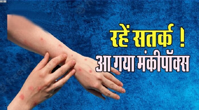रोहतक में मंकीपॉक्स का अलर्ट, अस्पतालों ने किये बेड रिजर्व, पीजीआई में बना आइसोलेशन वार्ड