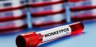 खुलासा, 8 वर्ष या उससे कम उम्र के बच्चों में मंकीपॉक्स का अधिक खतरा मंकीपॉक्स