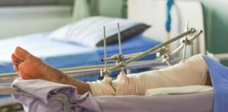 फ्रैक्चर व हड्डी उपचार के लिए आर्टिफिशियल इंटेलिजेंस आधारित मॉडल तैयार