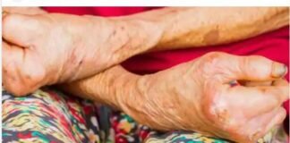 4 सालों में पूरे देश से खत्म हो जाएगी ये खतरनाक बीमारी खतरनाक बीमारी