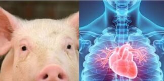 अब इंसान के अंदर धड़केगा सूअर का दिल