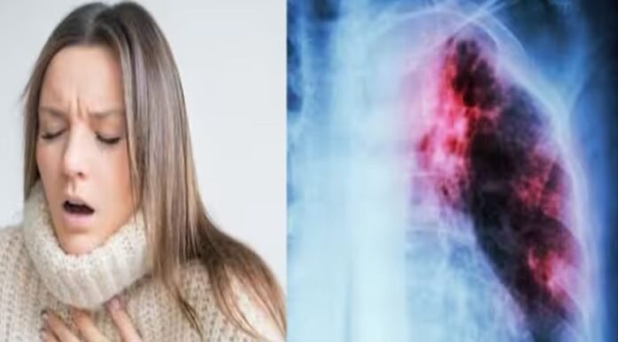 टीबी से हर साल लाखों लोगों की मौत, 1 मरीज 15 लोगों को करता हैं संक्रमित