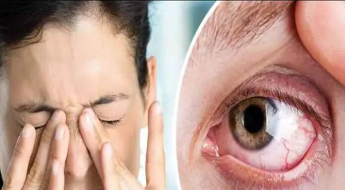 देश में तेजी से बढ़ रहा है आई फ्लू का खतरा