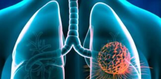 दिल्ली में 3 साल तक रहने पर कैंसर का खतरा