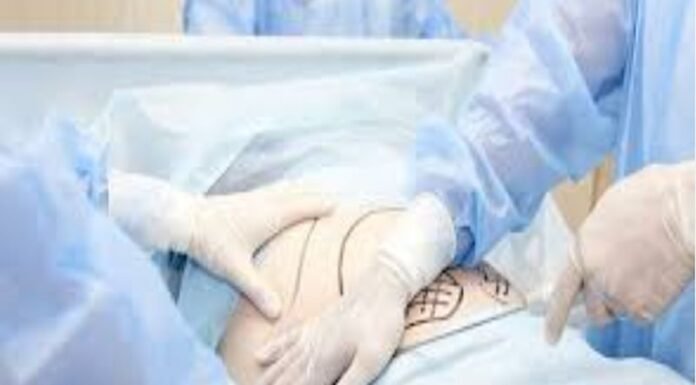 एक ही चाकू से डॉक्टर ने कई मरीजों की सर्जरी, इंफेक्शन से हुई मौत