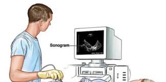 बिना डॉक्टर के चल रहे फर्जी अल्ट्रासाउंड पर छापेमारी